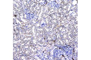 IHC analysis of CD44 using anti-CD44 antibody . (CD44 抗体  (AA 21-259))