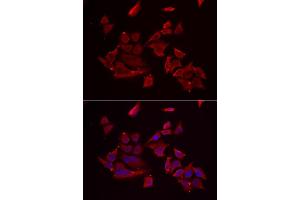 Immunofluorescence analysis of MCF-7 cell using RARRES2 antibody. (Chemerin 抗体)