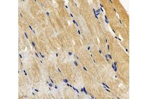 Immunohistochemistry analysis of paraffin-embedded mouse skeletal muscle using SGCA (ABIN7075509) at dilution of 1: 600 (SGCA 抗体)