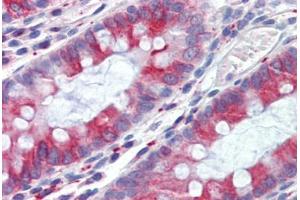 Human Colon (formalin-fixed, paraffin-embedded) stained with TUBB antibody ABIN462130 followed by biotinylated anti-mouse IgG secondary antibody ABIN481714, alkaline phosphatase-streptavidin and chromogen. (TUBB 抗体)