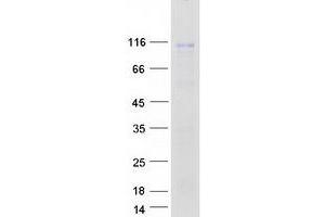 Western Blotting (WB) image for Junctophilin 2 (JPH2) (Transcript Variant 1) protein (Myc-DYKDDDDK Tag) (ABIN2723954)