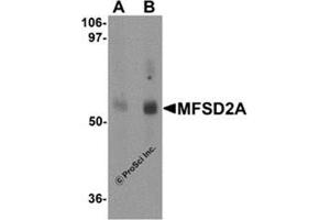 Western blot analysis of MFSD2A in rat lung tissue lysate with MFSD2A antibody at (A) 1 and (B) 2 μg/ml.