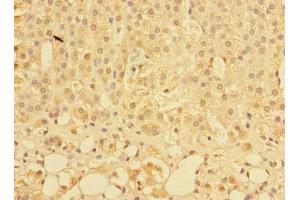Immunohistochemistry of paraffin-embedded human adrenal gland tissue using ABIN7163662 at dilution of 1:100 (C10orf81 抗体  (AA 181-462))