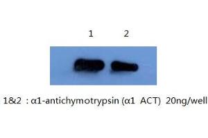 Western Blotting (WB) image for anti-serpin Peptidase Inhibitor, Clade A (Alpha-1 Antiproteinase, Antitrypsin), Member 3 (SERPINA3) antibody (ABIN1105306) (SERPINA3 抗体)