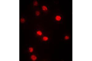 Immunofluorescent analysis of DNMT3B staining in A549 cells. (DNMT3B 抗体  (N-Term))