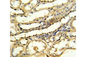 TRAP antibody IHC analysis in formalin fixed and paraffin embedded human kidney tissue (CD40 Ligand 抗体  (AA 33-62))