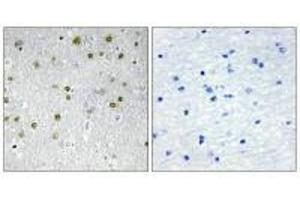 Immunohistochemistry analysis of paraffin-embedded human brain tissue, using NRIP2 antibody. (NRIP2 抗体  (N-Term))