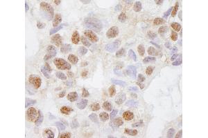 Immunohistochemistry (IHC) image for anti-DEAH (Asp-Glu-Ala-His) Box Polypeptide 38 (DHX38) (AA 1150-1200) antibody (ABIN7448529)