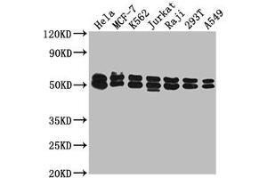 Western Blot Positive WB detected in: Hela whole cell lysate, MCF-7 whole cell lysate, K562 whole cell lysate, Jurkat whole cell lysate, Raji whole cell lysate, 293T whole cell lysate, A549 whole cell lysate All lanes: DNAJA3 antibody at 1:2000 Secondary Goat polyclonal to rabbit IgG at 1/50000 dilution Predicted band size: 53, 50, 34 kDa Observed band size: 53 kDa (DNAJA3 抗体  (AA 86-184))