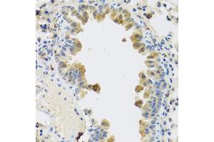Immunohistochemistry of paraffin-embedded mouse lung using RSPO1 antibody at dilution of 1:100 (40x lens). (RSPO1 抗体)