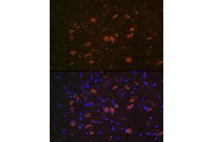 Immunofluorescence analysis of Rat brain using EL Rabbit pAb (ABIN7266914) at dilution of 1:100.