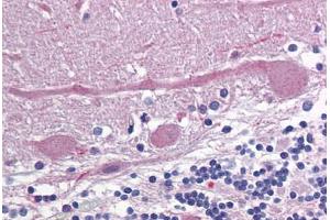 Human Brain, Cerebellum: Formalin-Fixed, Paraffin-Embedded (FFPE) (Glutamate Receptor 3 抗体  (N-Term))