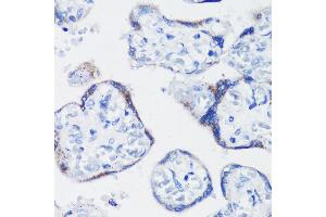 Immunohistochemistry of paraffin-embedded human placenta using KISS1 antibody (ABIN3017121, ABIN3017122, ABIN1680598 and ABIN6219966) at dilution of 1:200 (40x lens). (KISS1 抗体)