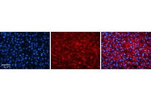 Rabbit Anti-TSPAN31 Antibody   Formalin Fixed Paraffin Embedded Tissue: Human Liver Tissue Observed Staining: Plasma membrane and cytoplasm in hepatocytes Primary Antibody Concentration: N/A Other Working Concentrations: 1:600 Secondary Antibody: Donkey anti-Rabbit-Cy3 Secondary Antibody Concentration: 1:200 Magnification: 20X Exposure Time: 0. (TSPAN31 抗体  (Middle Region))