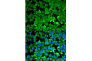 Immunofluorescence (IF) image for anti-Asparagine Synthetase (ASNS) antibody (ABIN1876738) (Asparagine Synthetase 抗体)