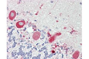 Immunohistochemistry (IHC) image for anti-Tumor Necrosis Factor Receptor Superfamily, Member 21 (TNFRSF21) (AA 356-385) antibody (ABIN1942955)