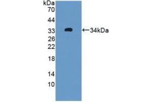 Detection of Recombinant OIT3, Rat using Polyclonal Antibody to Oncoprotein Induced Transcript 3 (OIT3) (OIT3 抗体  (AA 251-524))