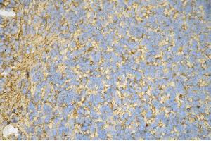 anti-Creatine Kinase, Brain (CKB) antibody