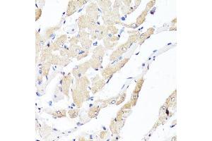 Immunohistochemistry (Paraffin-embedded Sections) (IHC (p)) image for anti-Yes-Associated Protein 1 (YAP1) antibody (ABIN1683302)