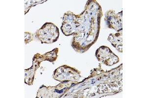 Immunohistochemistry (IHC) image for anti-Egl-9 Family Hypoxia Inducible Factor 3 (EGLN3) (AA 1-120) antibody (ABIN6139990)