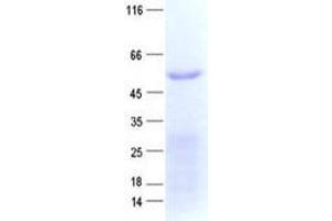 Western Blotting (WB) image for Zinc Finger Protein 480 (ZNF480) protein (His tag) (ABIN2736048)
