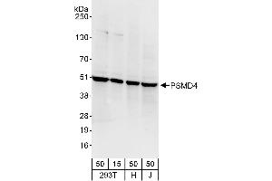 Western Blotting (WB) image for anti-Proteasome (Prosome, Macropain) 26S Subunit, Non-ATPase, 4 (Psmd4) (AA 250-300) antibody (ABIN7453925)