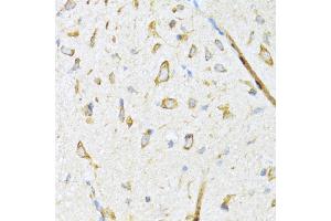 Immunohistochemistry (IHC) image for anti-DnaJ (Hsp40) Homolog, Subfamily B, Member 11 (DNAJB11) (AA 89-358) antibody (ABIN6139703)