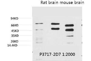 Western blot analysis of 1) Hela, 2) Rat Brain Tissue, 3) Mouse Brain Tissue with Phosphoserine Mouse mAb diluted at 1:2000. (Phosphoserine 抗体)