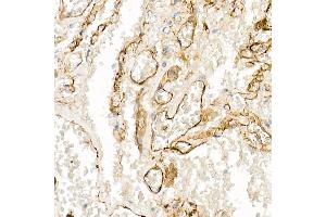 Immunohistochemistry (IHC) image for anti-S100 Calcium Binding Protein A10 (S100A10) (AA 1-97) antibody (ABIN3015804)