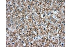 Immunohistochemical staining of paraffin-embedded liver tissue using anti-NIT2 mouse monoclonal antibody. (NIT2 抗体)