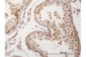 Immunoperoxidase of purified MaxPab antibody to FBXO7 on formalin-fixed paraffin-embedded human testis. (FBXO7 抗体  (AA 1-522))