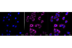 Immunocytochemical staining of HeLa cells with Acyl-CoA dehydrogenase short chain antibody (ABIN7797493), 1:1,000). (Recombinant Acyl Co-A Dehydrogenase (AIDB) (chain short) 抗体)