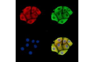 ABIN7095879 and ABIN7099941 staining Hela cells by IF/ICC.