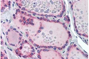 Human Thyroid (formalin-fixed, paraffin-embedded) stained with TRHR antibody ABIN290227 at 10 ug/ml followed by biotinylated goat anti-rabbit IgG secondary antibody ABIN481713, alkaline phosphatase-streptavidin and chromogen. (TRHR 抗体  (AA 350-400))