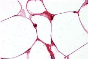 Adipocytes, Human: Formalin-Fixed, Paraffin-Embedded (FFPE) (FABP4 抗体  (Tyr20))
