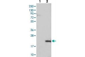 Western blot analysis of Lane 1: Negative control (vector only transfected HEK293T lysate), Lane 2: Over-expression Lysate (Co-expressed with a C-terminal myc-DDK tag (~3. (LYZL6 抗体)