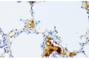 Immunohistochemistry of paraffin-embedded Mouse lung using CTRB1 Polyclonal Antibody at dilution of 1:100 (40x lens). (CTRB1 抗体)