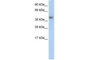 WB Suggested Anti-ZNF620 Antibody Titration: 2. (ZNF620 抗体  (Middle Region))