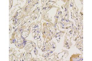 Immunohistochemistry of paraffin-embedded human lung using ARRB1 antibody (ABIN5996907) at dilution of 1/100 (40x lens). (beta Arrestin 1 抗体)