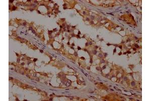 Immunohistochemistry (IHC) image for anti-Olfactory Receptor, Family 1, Subfamily K, Member 1 (OR1K1) (AA 261-273) antibody (ABIN7139968)