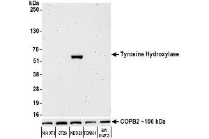 anti-Tyrosine Hydroxylase (TH) (AA 450-500) antibody
