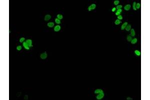Immunofluorescent analysis of MCF-7 cells using ABIN7139274 at dilution of 1:100 and Alexa Fluor 488-congugated AffiniPure Goat Anti-Rabbit IgG(H+L) (HIST1H1E 抗体  (2meLys16))