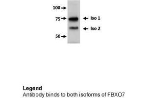 FBXO7 antibody - middle region  validated by WB using U2OS cells at 0. (FBXO7 抗体  (Middle Region))