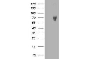 Western Blotting (WB) image for anti-LIM Domain Kinase 1 (LIMK1) antibody (ABIN1499153) (LIM Domain Kinase 1 抗体)