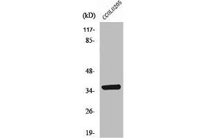 Western Blot analysis of COLO205 cells using AASD-PPT Polyclonal Antibody