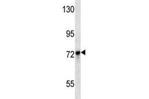 KEAP1 antibody western blot analysis in MDA-MB231 lysate. (KEAP1 抗体  (AA 422-449))