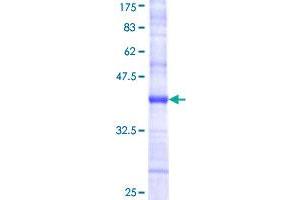 Image no. 1 for Platelet Derived Growth Factor D (PDGFD) (AA 24-123) protein (GST tag) (ABIN1314508)