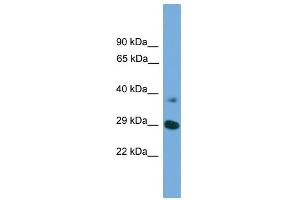 WB Suggested Anti-ATG16L1  Antibody Titration: 0. (ATG16L1 抗体  (Middle Region))