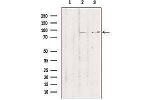Western blot analysis of extracts from various samples, using ZNF148 Antibody. (ZNF148 抗体  (N-Term))