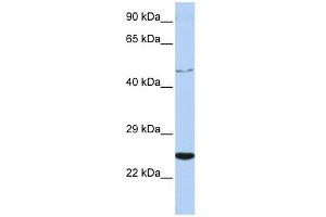 CRLF1 antibody used at 1 ug/ml to detect target protein. (CRLF1 抗体  (Middle Region))